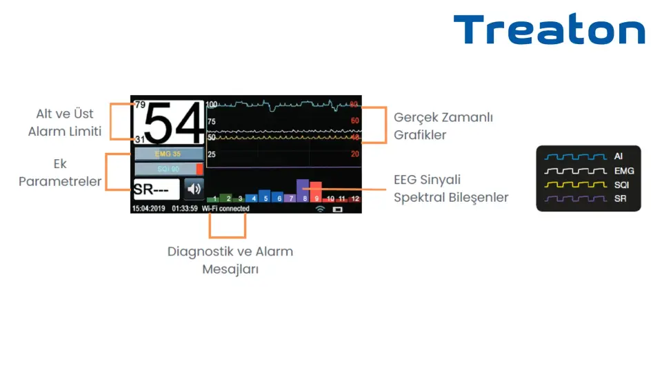 MGA-06 ANESTEZİ DERİNLİK MONİTÖRÜ (BIS MONİTÖRÜ)