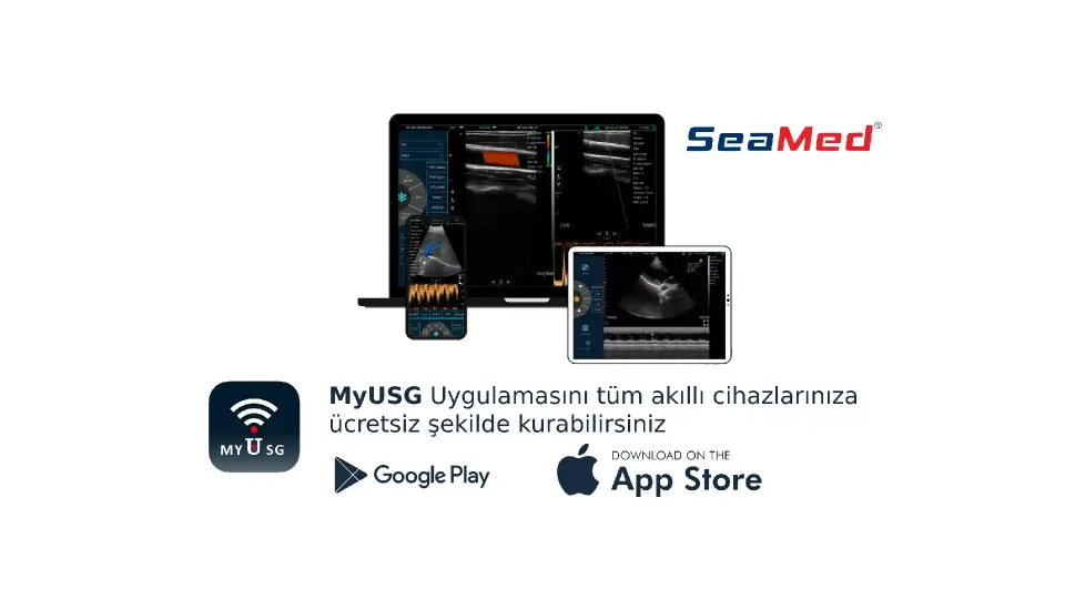 KONTED LINEER EL TİPİ KABLOSUZ ULTRASON