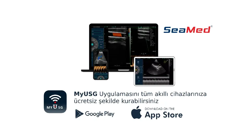 KONTED KONVEKS EL TİPİ KABLOSUZ ULTRASON