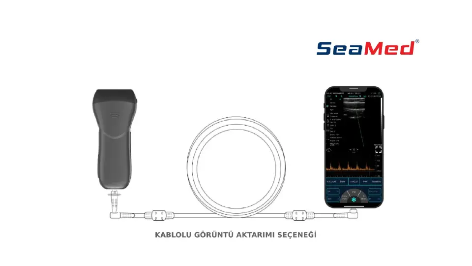 KONTED KONVEKS EL TİPİ KABLOSUZ ULTRASON