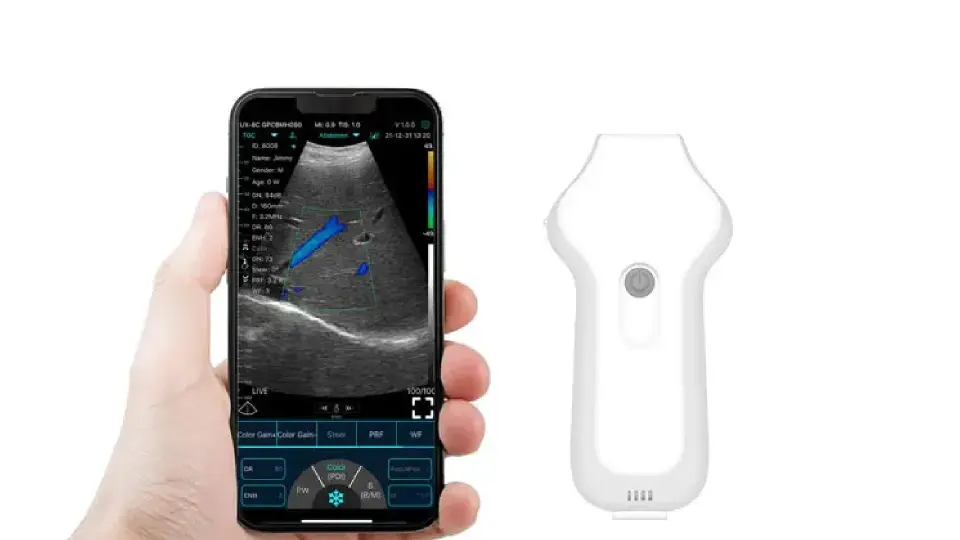 KONTED KARDİYAK EL TİPİ KABLOSUZ ULTRASON